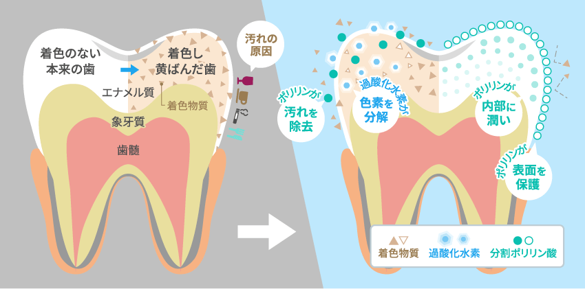 ホワイトニングイメージ